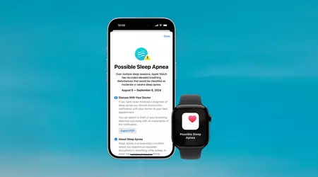 L'Apple Watch riceve l'approvazione canadese per il rilevamento dell'apnea notturna