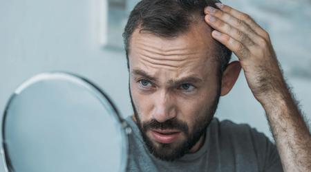 Gli scienziati hanno scoperto una proprietà inaspettata dello zucchero del DNA che potrebbe risolvere la perdita di capelli negli uomini e nelle donne
