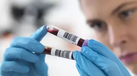 Scienziati cinesi creano un test del sangue AI che diagnostica le malattie 15 anni prima della comparsa dei sintomi