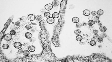Un laboratorio australiano ha perso virus pericolosi a causa di un guasto al congelatore