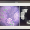 Google e il Pentagono hanno sviluppato un microscopio basato sull'intelligenza artificiale per la diagnosi del cancro-6 Google e il Pentagono hanno sviluppato un microscopio basato sull'intelligenza artificiale per la diagnosi del cancro-6