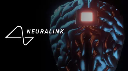 Ampliamento del programma Neuralink: i volontari di tutto il mondo possono ora candidarsi per l'impianto dell'innovativo neurochip