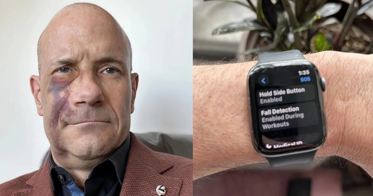 Come l'Apple Watch ha contribuito a salvare la vita di un ciclista Come l'Apple Watch ha contribuito a salvare la vita di un ciclista