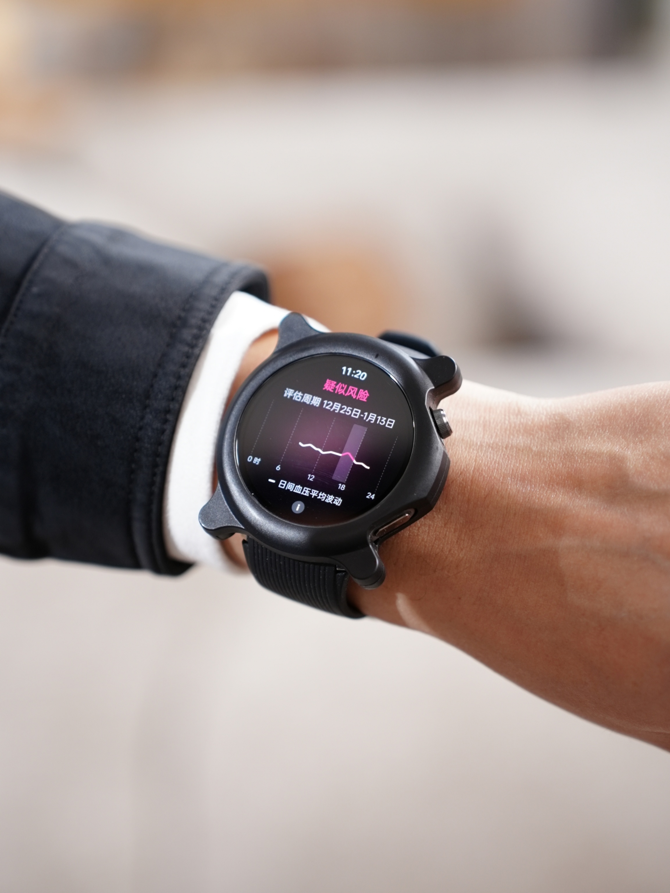 Il nuovo Oppo Watch X2 in una custodia protettiva