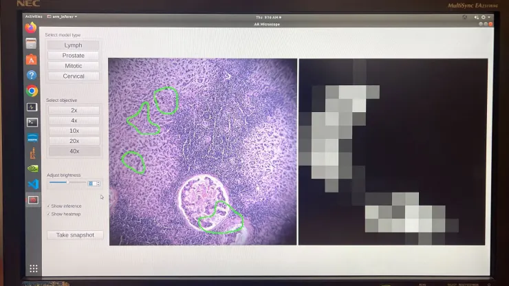Google e il Pentagono hanno sviluppato un microscopio basato sull'intelligenza artificiale per la diagnosi del cancro-3 Google e il Pentagono hanno sviluppato un microscopio basato sull'intelligenza artificiale per la diagnosi del cancro-3