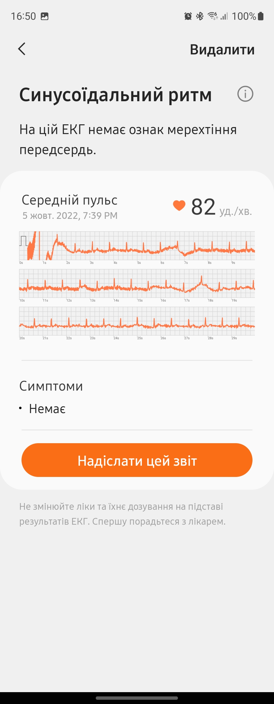 Recensione di Samsung Galaxy Watch5 Pro e Watch5: più durata della batteria, meno ghiera fisica-229 Recensione di Samsung Galaxy Watch5 Pro e Watch5: più durata della batteria, meno ghiera fisica-229