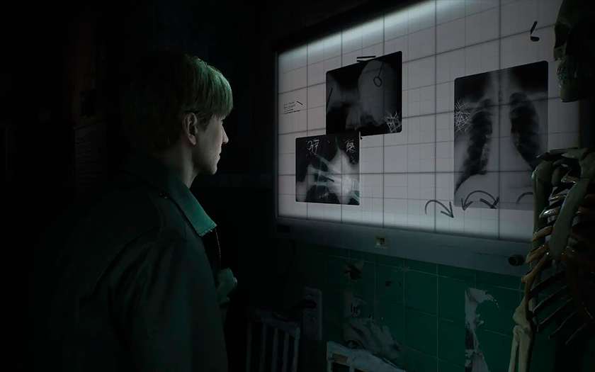Inquietante e nebbioso: Konami ha annunciato il remake di Silent Hill 2. Sviluppato da Bloober Team, il gioco uscirà su PC e PlayStation 5.-2 Inquietante e nebbioso: Konami ha annunciato il remake di Silent Hill 2. Sviluppato da Bloober Team, il gioco uscirà su PC e PlayStation 5.-2